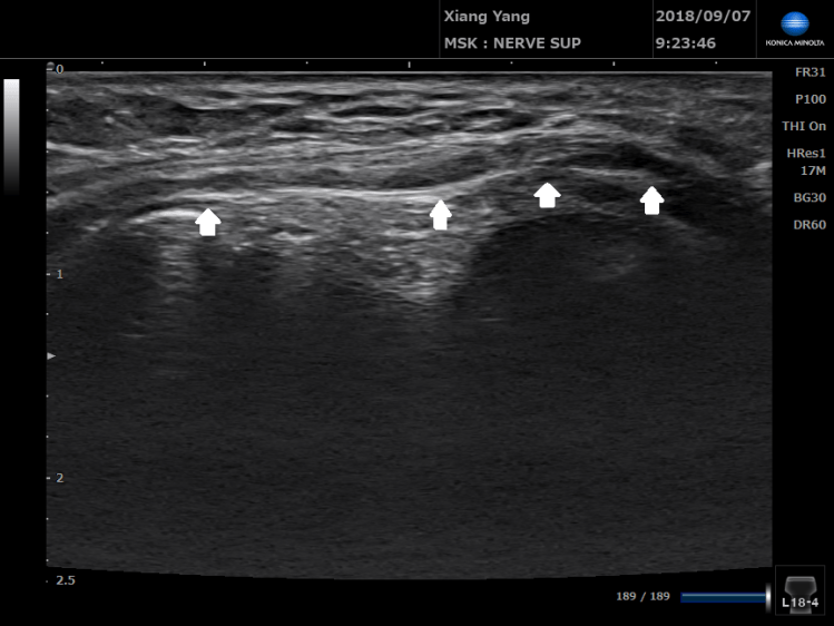 20180907092402236-10