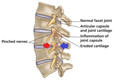 A_Completed_5_Glutes_Intro_-_Amended_0816__page_125_of_200_large