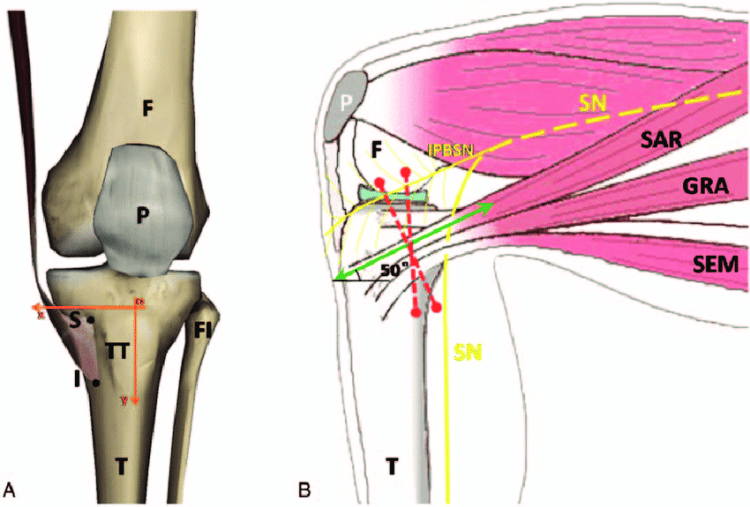 The-diagram-of-pes-anserinus-saphenous-nerve-distribution-and-tibia-A-F-femur-FI
