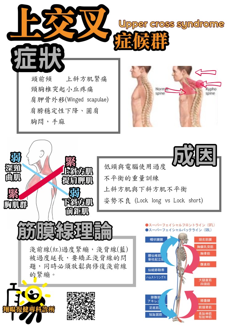 上交叉症候群