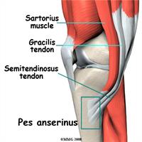 pes-anserinus-bursitis